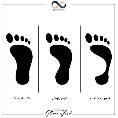 تشخیص صافی کف پا